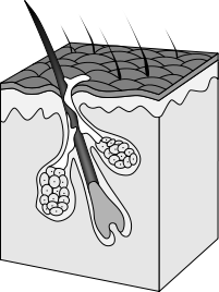 Clogged pores and hair follicles can cause acne.