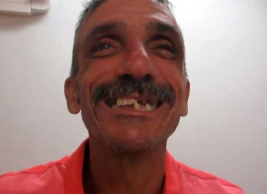 This is Martin's smile before the dentists did their work.