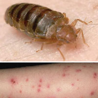 What do bed bug bites look like?