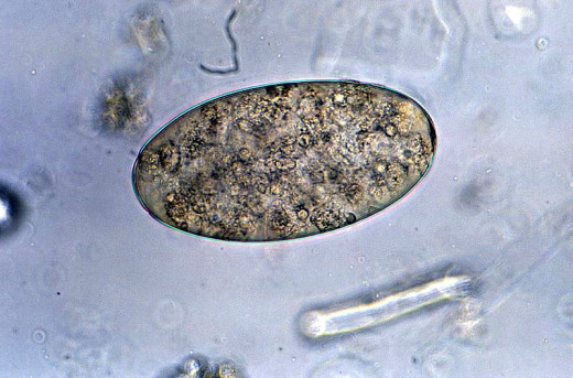Bad parasite: Fasciolopsis buski egg (fluke worm egg)