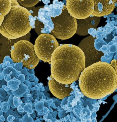 Staphylococcus Aureus, commonly known as Golden Staph is constantly giving rise to newer forms of the disease which are antibiotic resistant