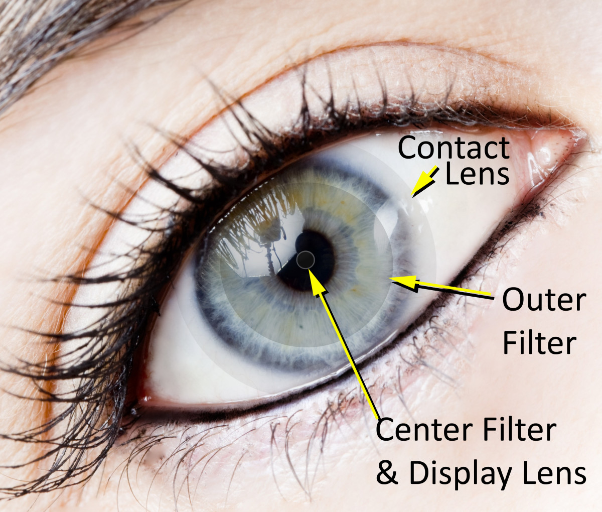 What are some natural factors that can cause eye pressure?