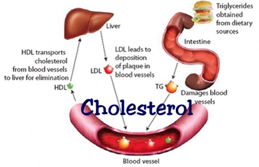 How Cholesterol Deposits