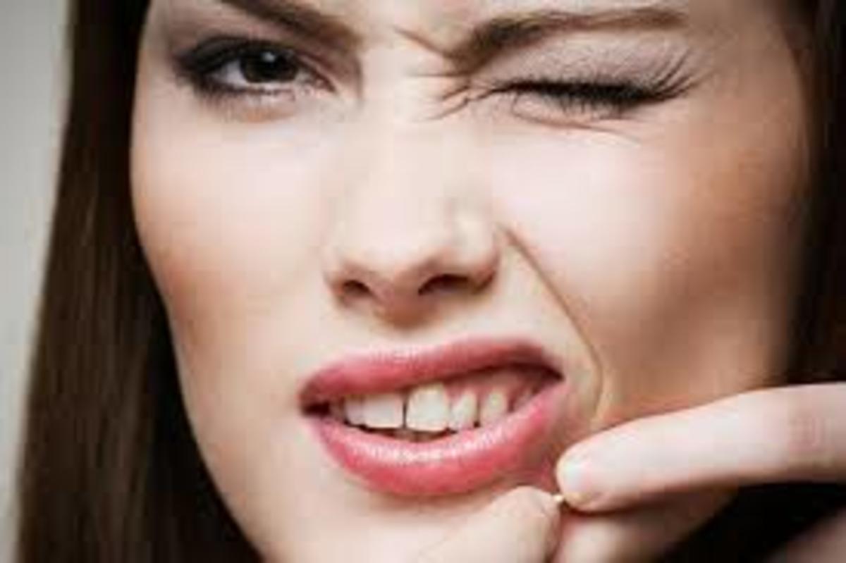 Acne-Real Causes and Treatments