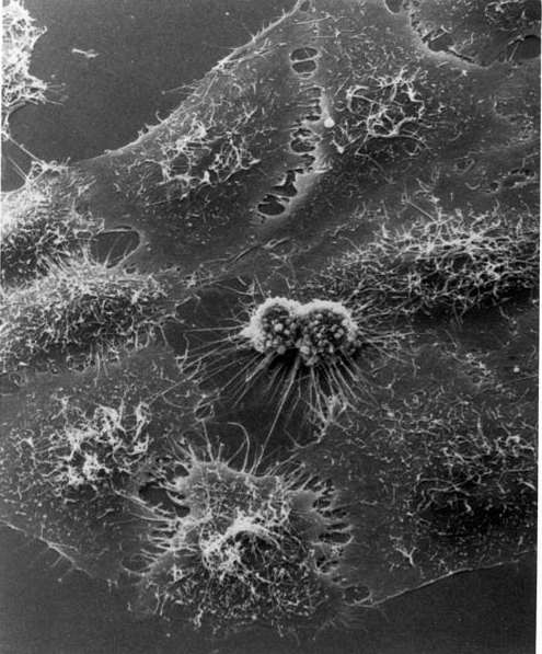 HeLa cells dividing under electron microscopy
