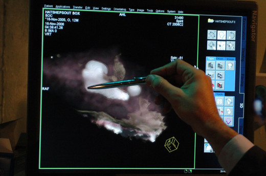 CT scan of the coffer