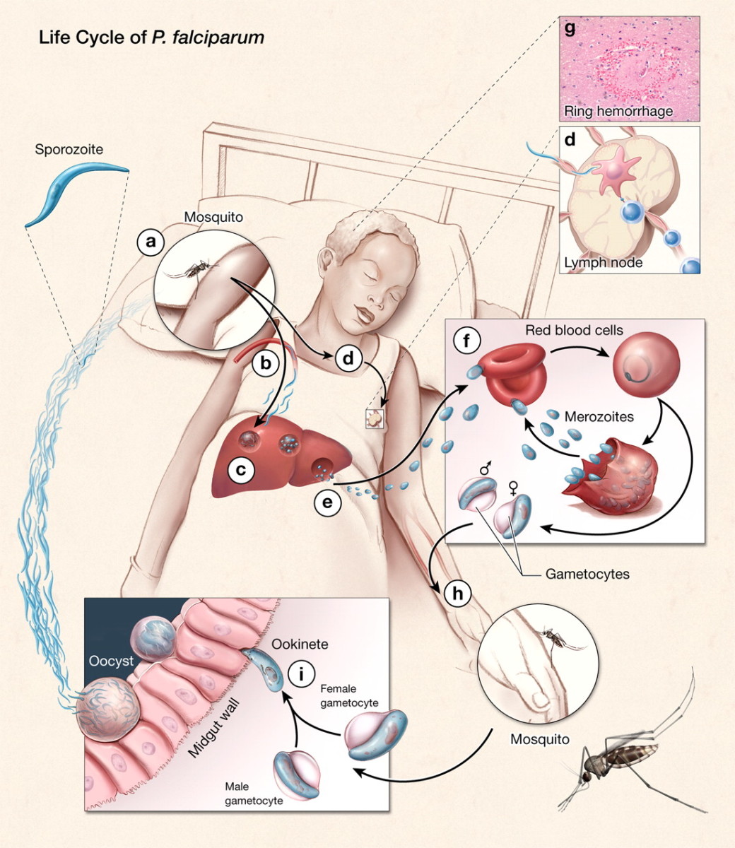 The Clinical Significance Of The Malaria Parasite: Pathology And Route Of Transmission