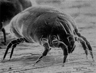 House dust mite, its feces and chitin (the exoskeleton of insects or fungi) are common  allergens found in homes.