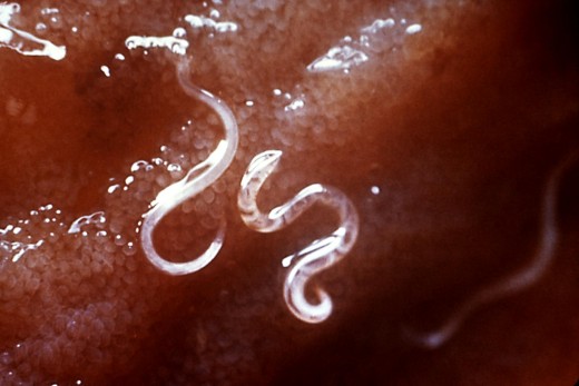 Ascariasis, ancylostomiasis, schistosomiasis and filariasis are the most widespread helminthic parasites affecting extensive geographical belts and millions of people. In many poor communities helminthiasis may be evident even at the age of 1 year, i
