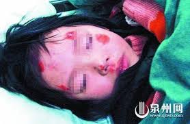 A 3-year-old Chinese girl was beaten and thrown from a taxi by her father, Gan X (May 2013)  