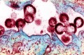 3 Health Stories that Are Worth Paying Attention To