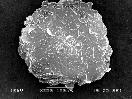 EEEk! A microscope picture of human dandruff...