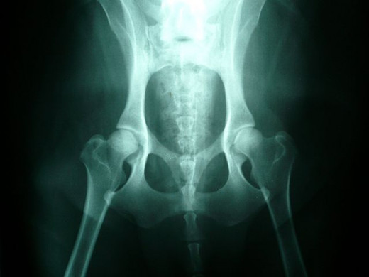 Normal canine hips as seen on x-ray 