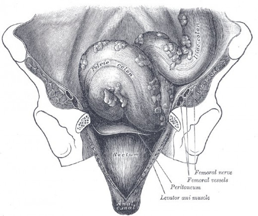 Image shows front view of the iliac, sigmoid, and pelvic colons, and rectum.