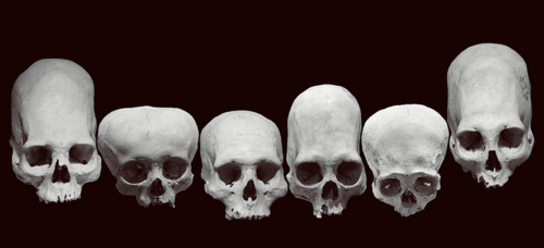 There is no doubt about the wide variation in the human skeleton and skull. Is this a product of our own manipulation or that of some outside force with their own agenda?