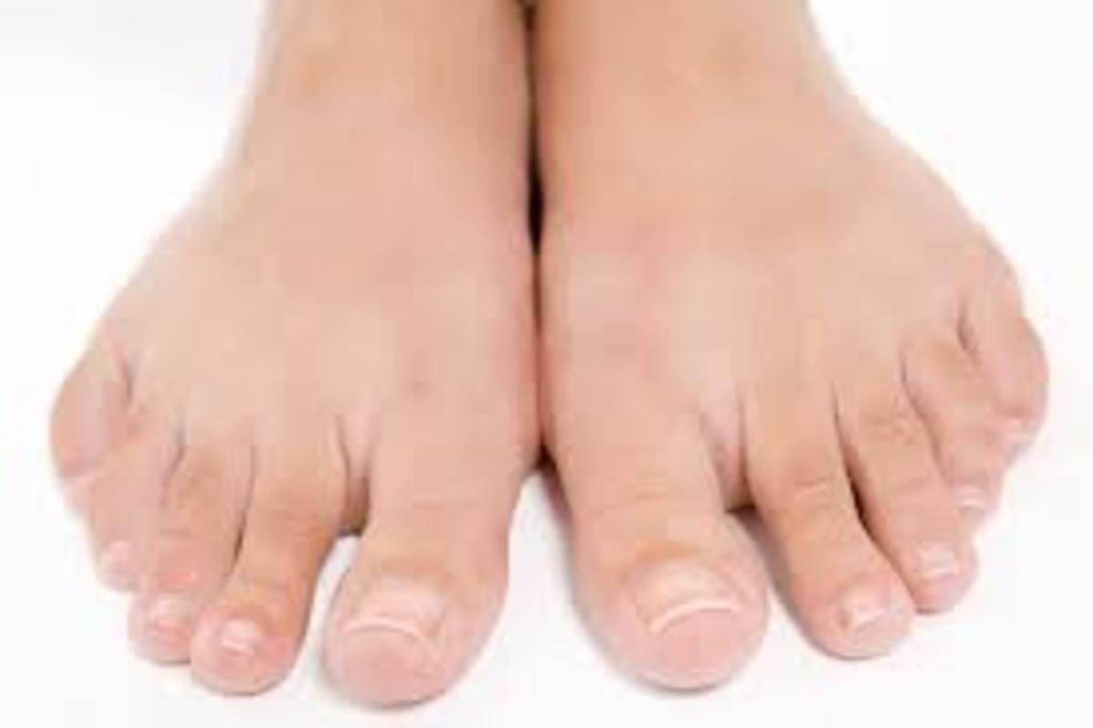 What are some of the problems associated with poor circulation in the foot?