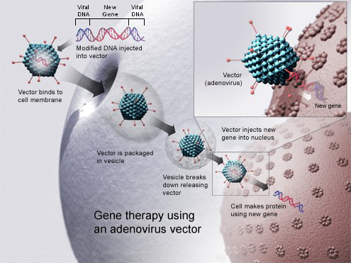  An adenovirus vector is used to insert a new gene into a cell, if successful, the new gene will make functional protein to treat a disease.