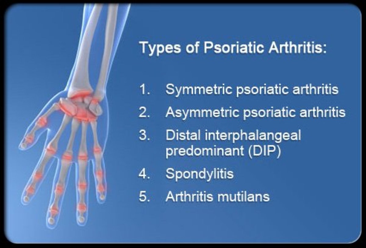 Symptoms Causes And Treatment Of Psoriatic Arthritis Healthproadvice