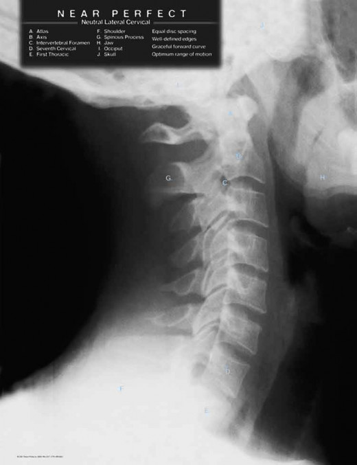 Notice the C Curve. Notice the bones are formed properly with spaces in between for the discs. 