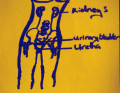 What Is a Urinary Tract Infection?