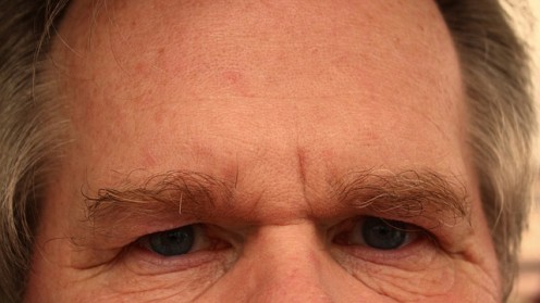 Easy Treatment and Tips for Flaky and Dry Skin on Forehead and Face Easy Treatment and Tips for Flaky and Dry Skin on Forehead and Face