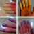 Raynaud's phenomenon: white and blue fingertips Raynaud's phenomenon: white and blue fingertips