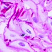 YeastInfectionPix profile image