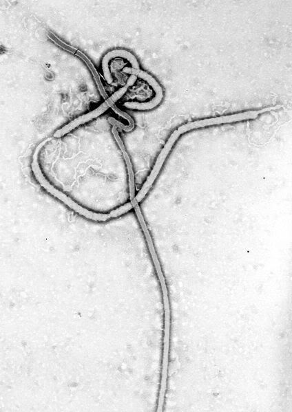 Ebola Virus (like cooked spaghetti noodles)