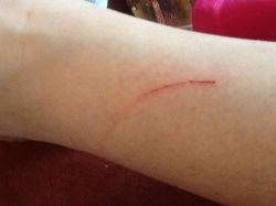 Just one of the many scratches he left on my legs when he attacked