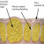 The anatomy of cellulite The anatomy of cellulite