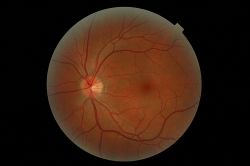 Neat photo of the eye's retina, not sure how this photo was taken though.